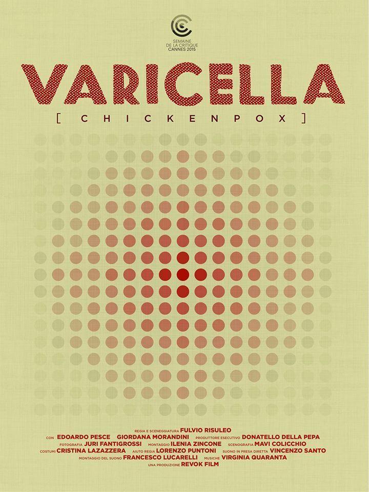 Varicella (C)