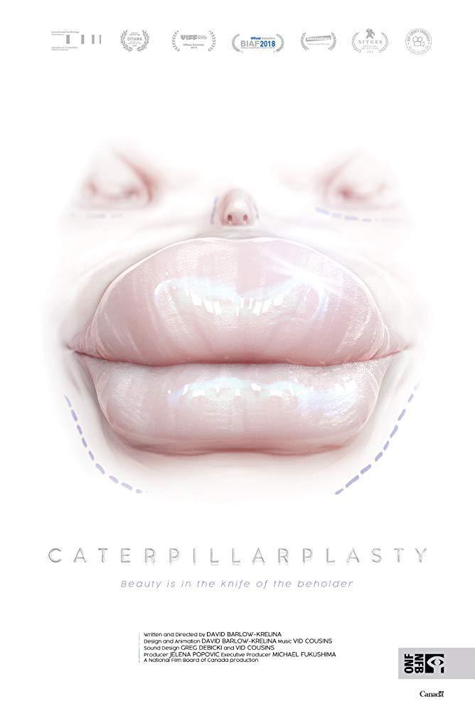 Caterpillarplasty (C)